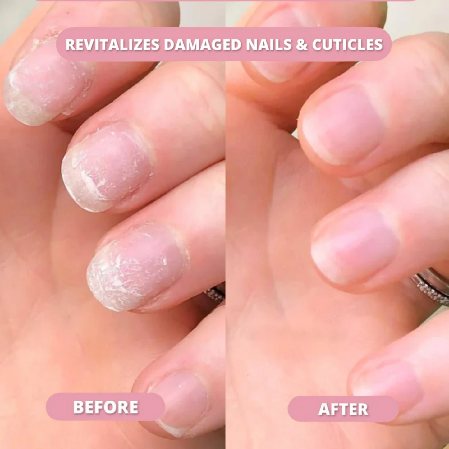 Stem Cells Nail Growth Pen™