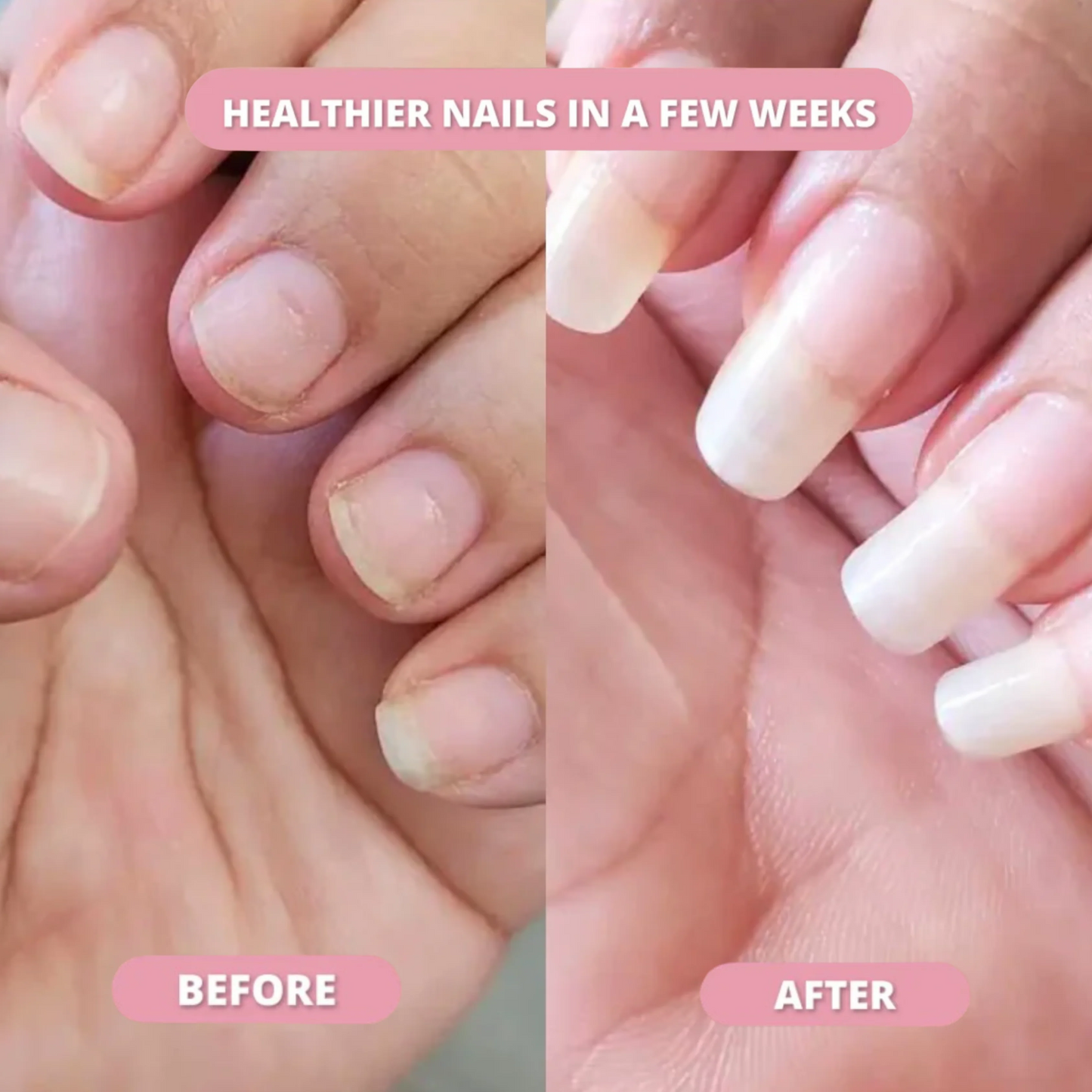 Stem Cells Nail Growth Pen™